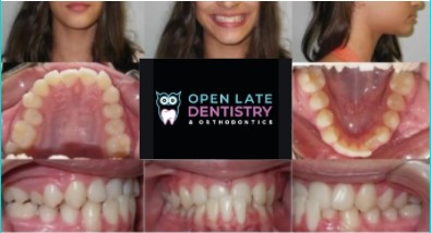 Orthodontic Photo Series Virtual Consult Dr Rouse Celina Dentist Tx Logo