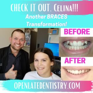 Orthodontist Celina TX Texas Orthodontic Care Braces Dr. Rouse Open Late Dentistry Prosper Gunter