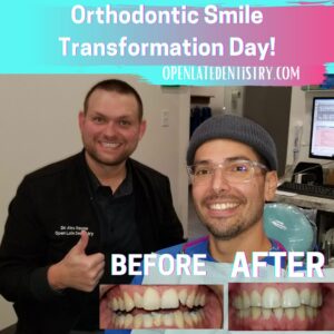 Smile Makeover Celina Gunter Prosper TX Dr. Rouse Open Late Dentistry and Orthodontics